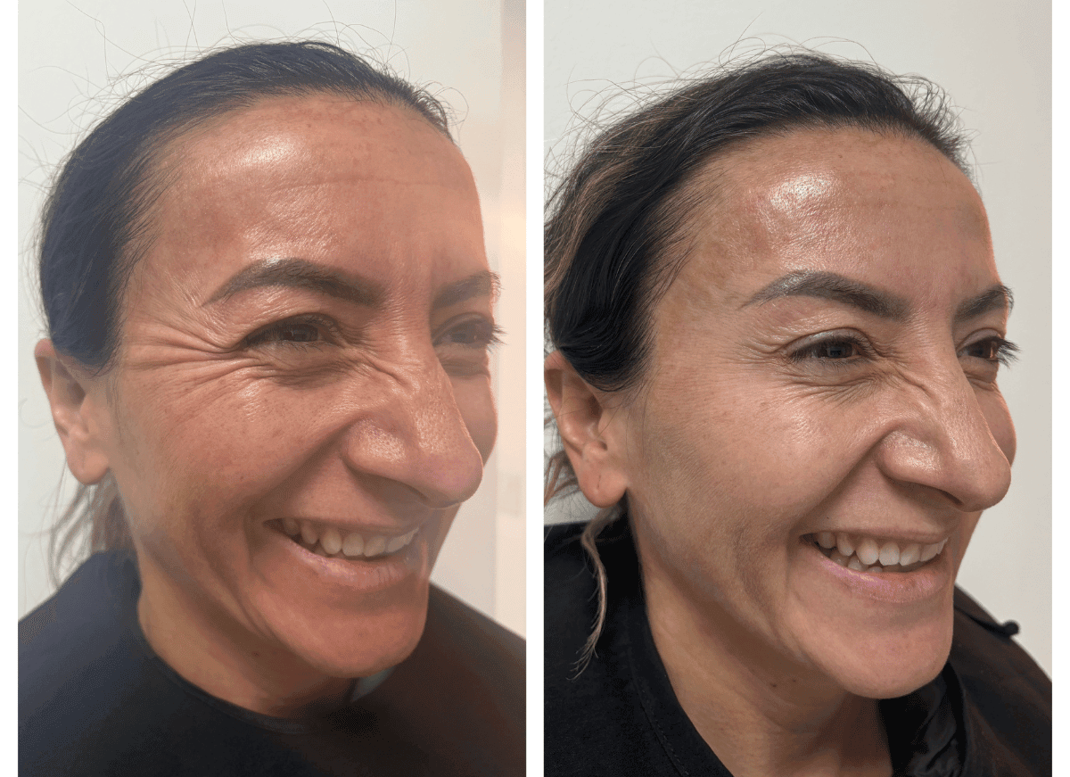 Clínica Inizios antes y después