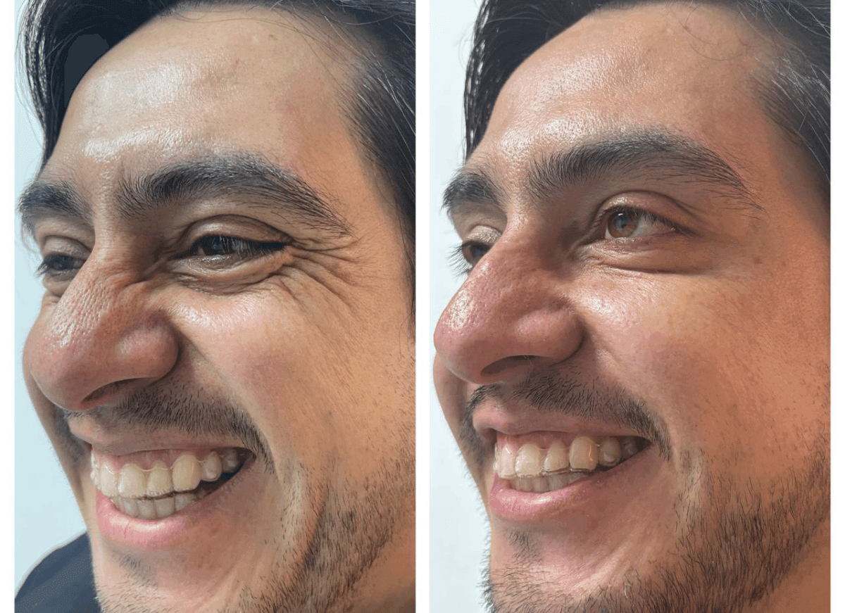 Clínica Inizios antes y después