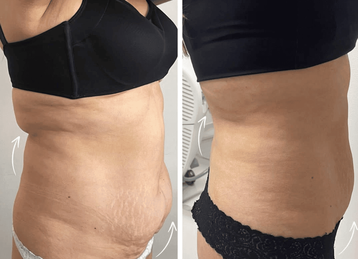 Clínica Inizios antes y después